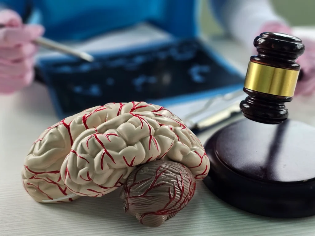 Charlotte Brain Injury Attorneys